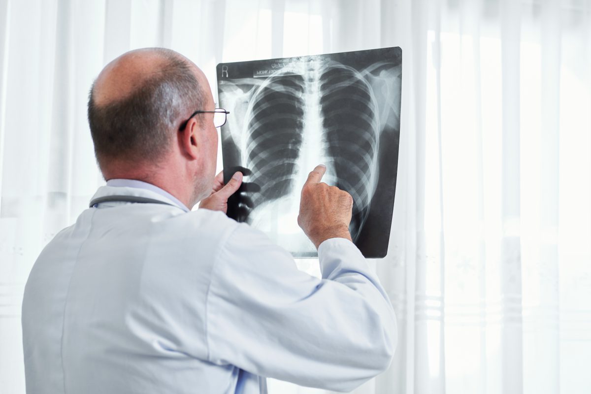 New CT Scan For Lung Cancer | Bluegrass Regional Imaging